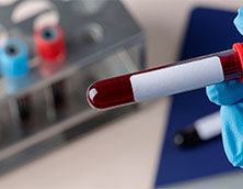 Qu'est-ce que le tube de collecte de sang et pourquoi est-ce important? 
